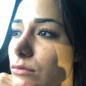 This is me! No filter, no makeup. This skin is caused by food, stress, dry air a...