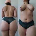 Back or Front?