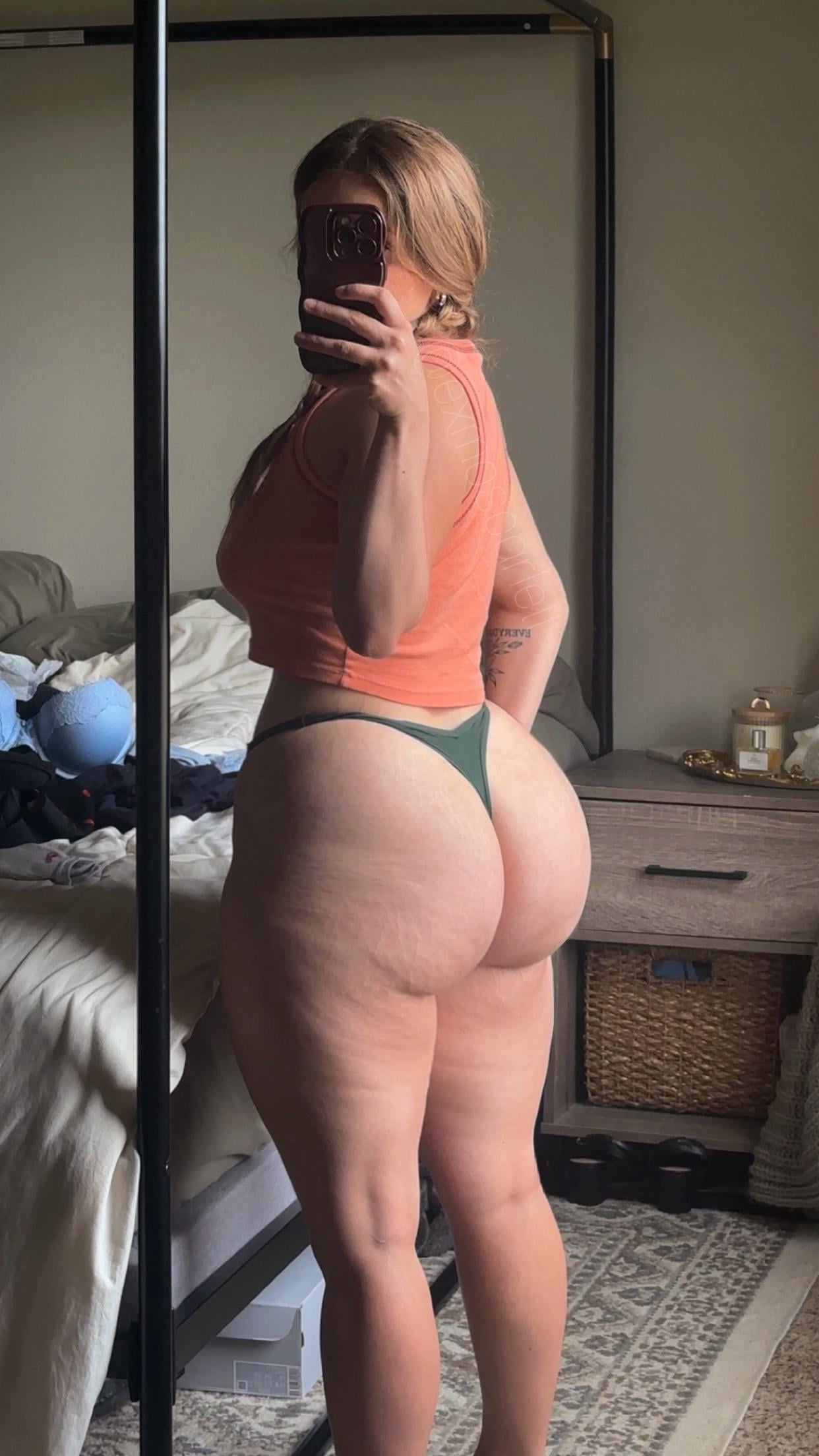 Thicker stretch marks included